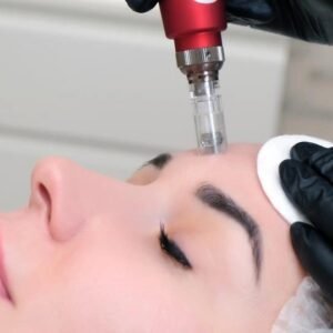 Microneedling Level 8 Advanced Diploma Course Thumbnail