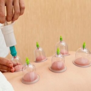 Cupping Therapy Level 3 Advanced Diploma Course Thumbnail