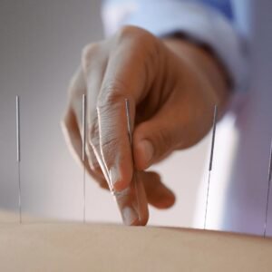 Acupuncture for Pain Relief and Well-Being Course Thumbnail